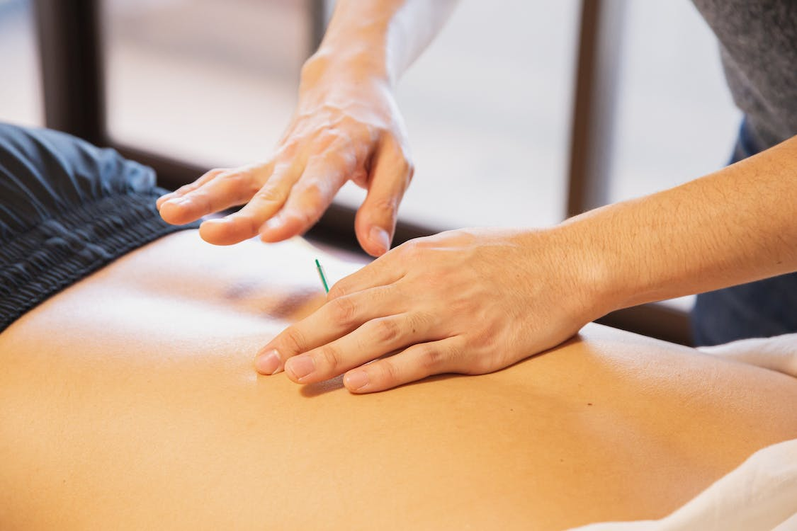 Beyond the Needle: Exploring the Benefits of Dry Needling for Pain Relief and Recovery